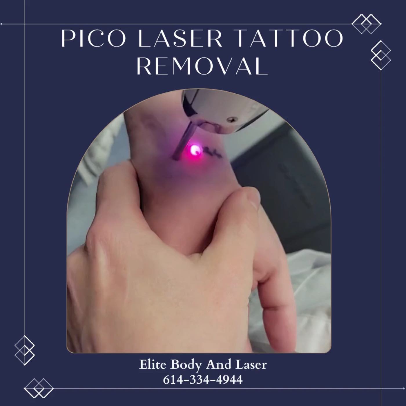 Elite Body & Laser Center, Columbus Ohio